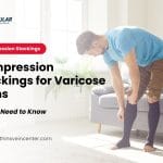 Compression Stockings for Varicose Veins: All You Need to Know