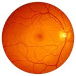 Expert Retina Care at Nandadeep Eye Hospital